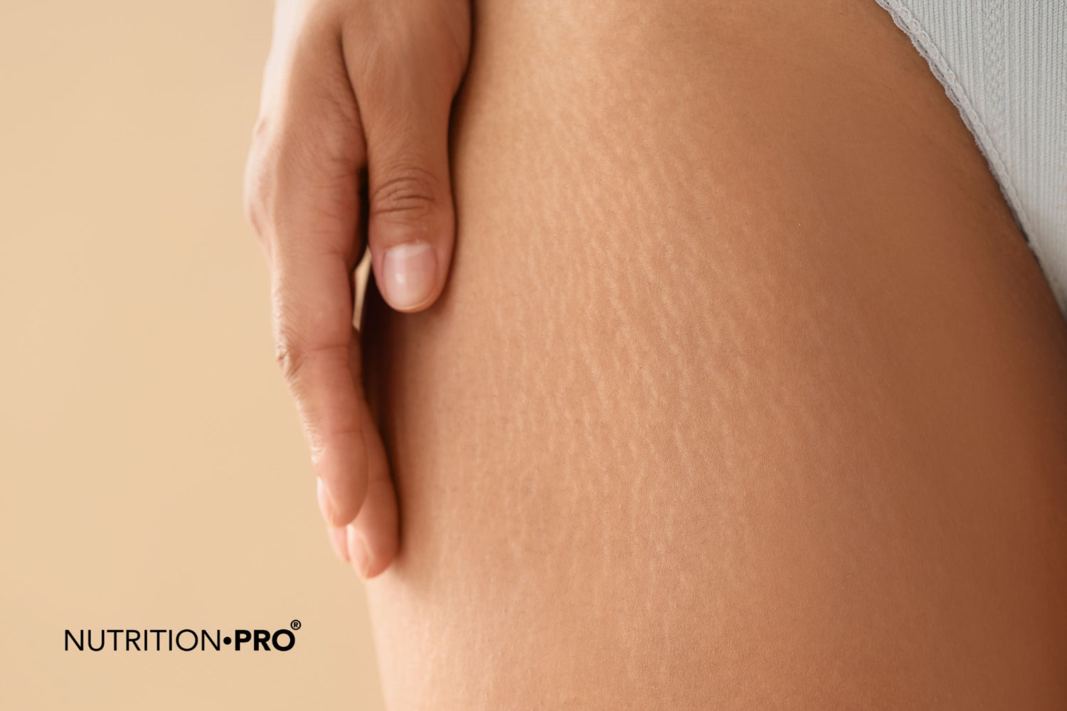 Cellulite : causes, mécanismes et traitements naturels efficaces