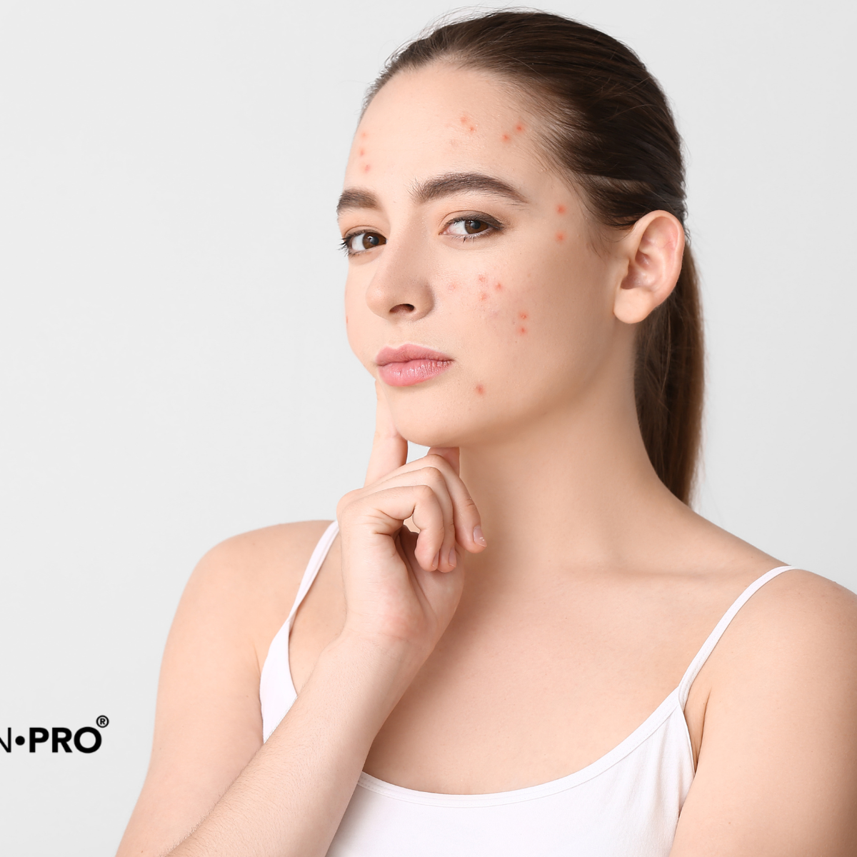 vitamin b5 l carnitine acne Acné et compléments : ce qui marche vraiment Kenalog Injection Size:1 Box My daily wellness duo!