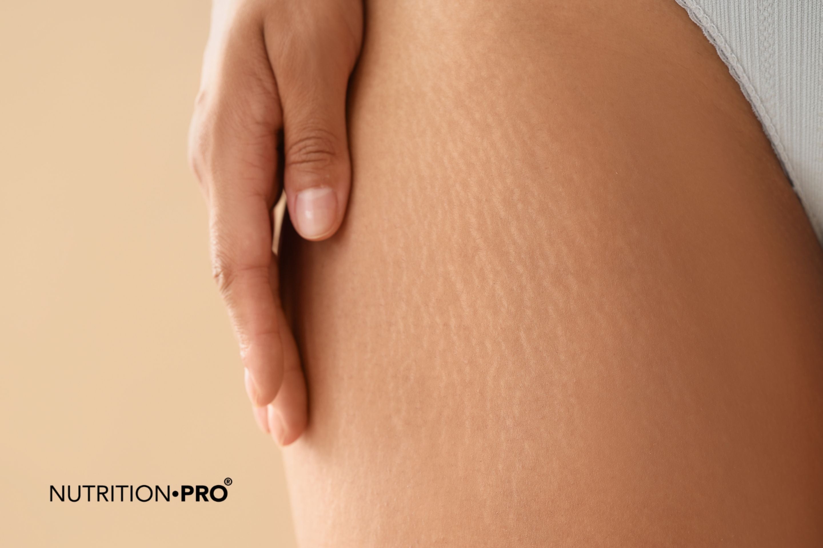 Cellulite : causes, mécanismes et traitements naturels efficaces