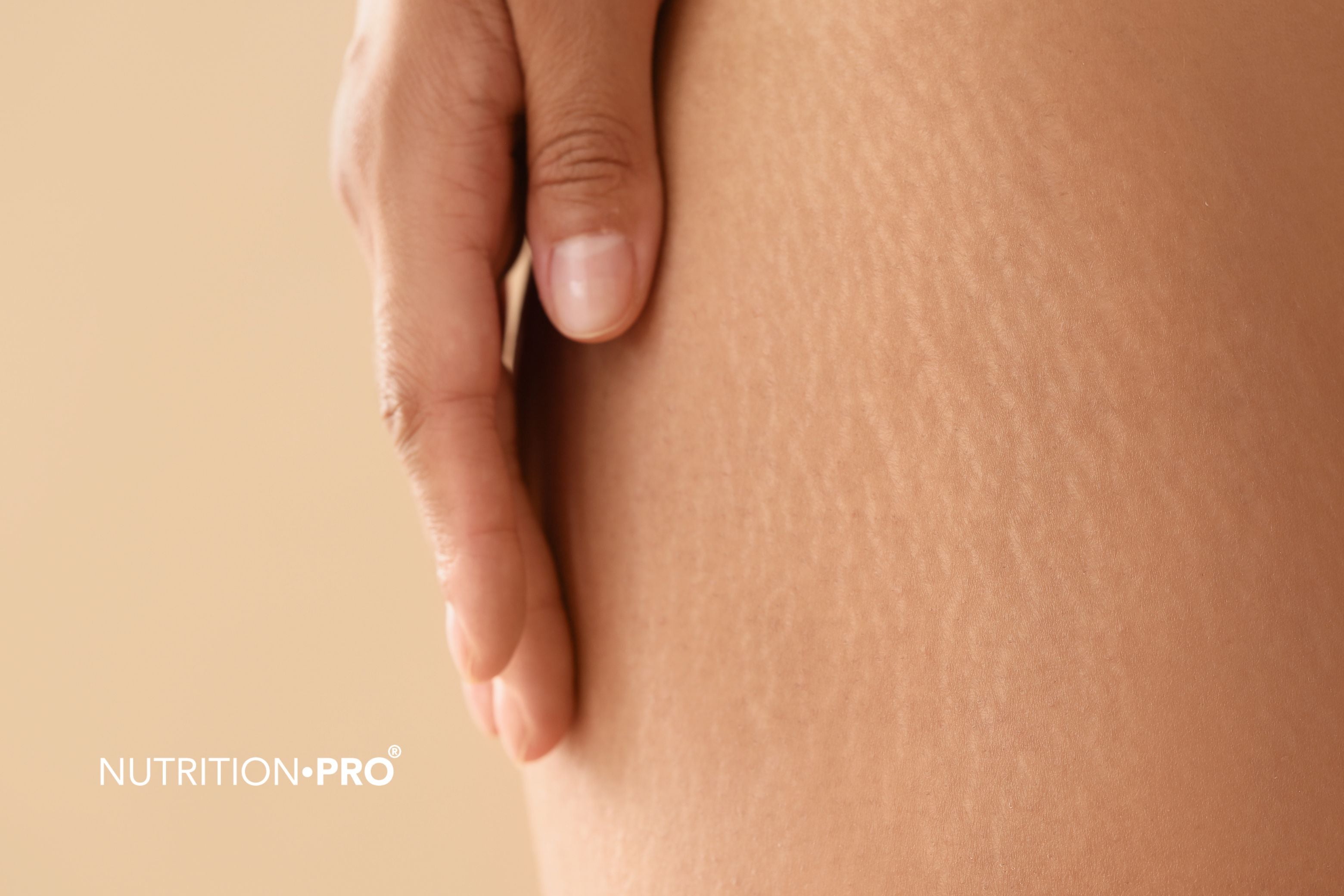 Jambes lourdes : 11 remèdes naturels validés (guide complet)