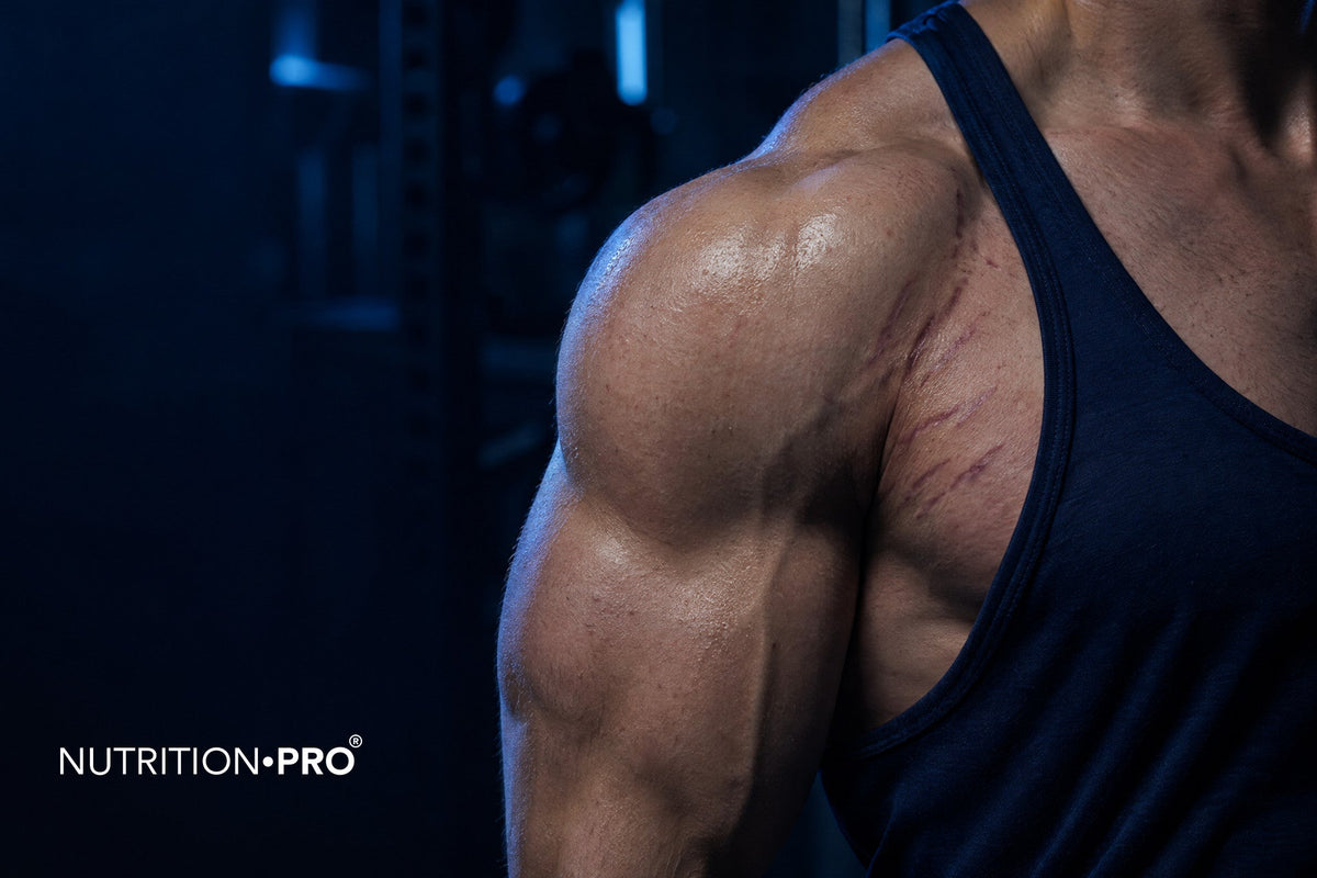 Vergetures et musculation : vergetures rouges sur l'épaule après une prise de masse